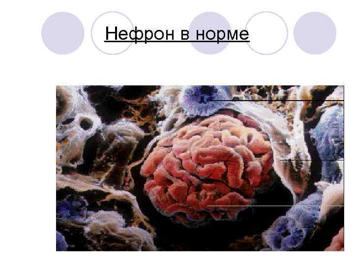 Нефрон в норме 