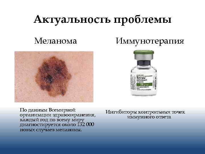 Актуальность проблемы Меланома По данным Всемирной организации здравоохранения, каждый год по всему миру диагностируется