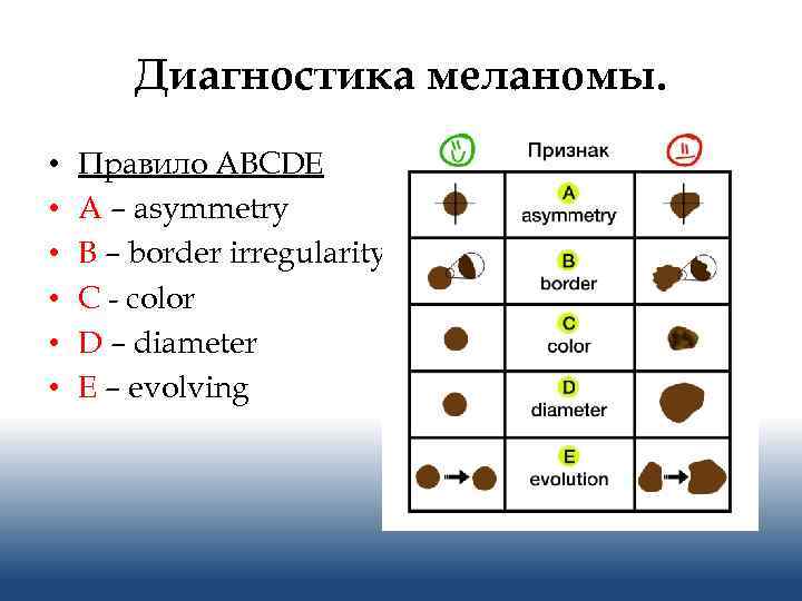 Диагностика меланомы. • • • Правило ABCDE A – asymmetry B – border irregularity