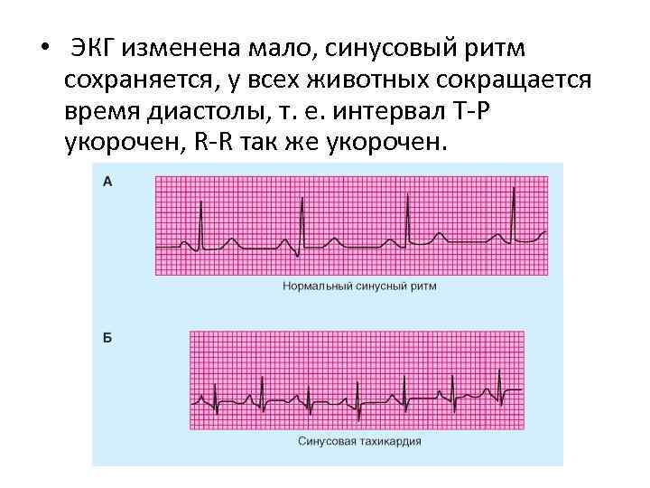  • ЭКГ изменена мало, синусовый ритм сохраняется, у всех животных сокращается время диастолы,