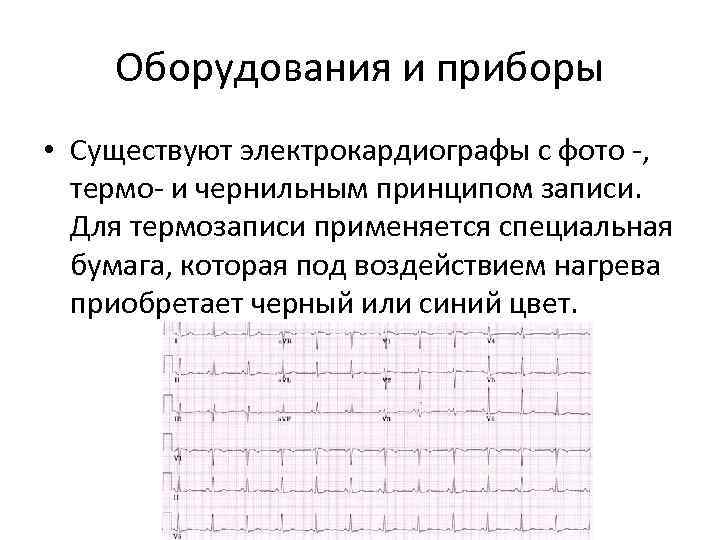 Оборудования и приборы • Существуют электрокардиографы с фото -, термо- и чернильным принципом записи.