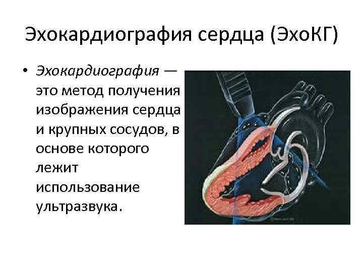 Эхокардиография сердца (Эхо. КГ) • Эхокардиография — это метод получения изображения сердца и крупных