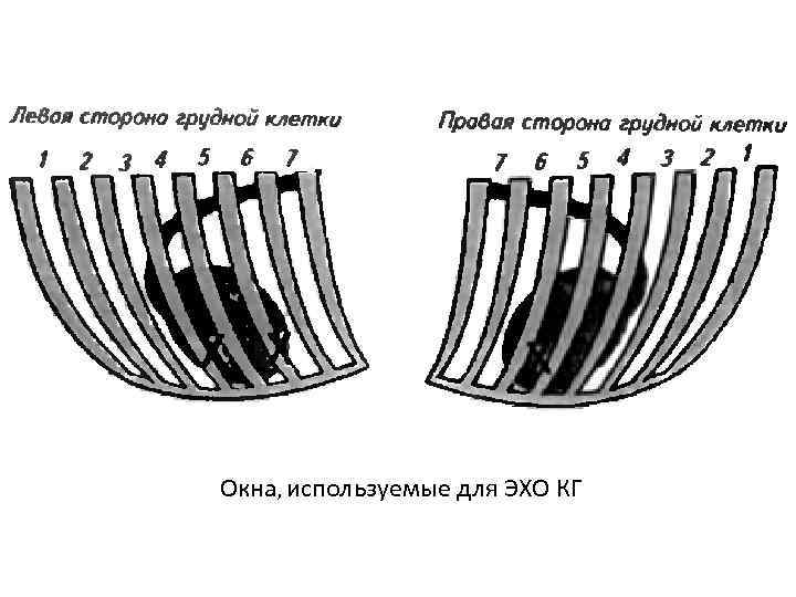 Окна, используемые для ЭХО КГ 