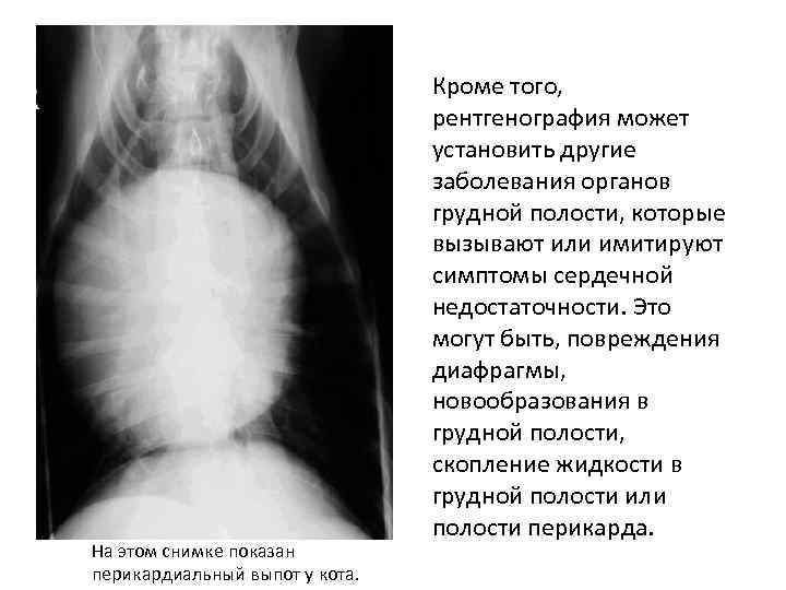 На этом снимке показан перикардиальный выпот у кота. Кроме того, рентгенография может установить другие