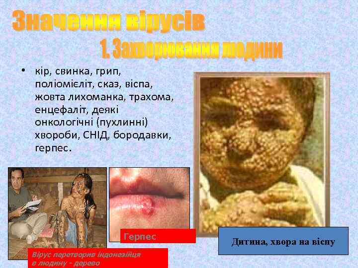  • кір, свинка, грип, поліомієліт, сказ, віспа, жовта лихоманка, трахома, енцефаліт, деякі онкологічні