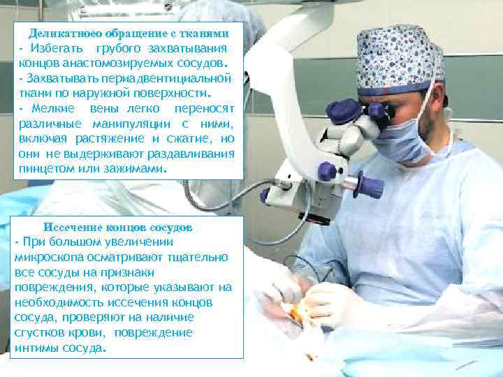 Деликатноео обращение с тканями - Избегать грубого захватывания концов анастомозируемых сосудов. - Захватывать периадвентициальной