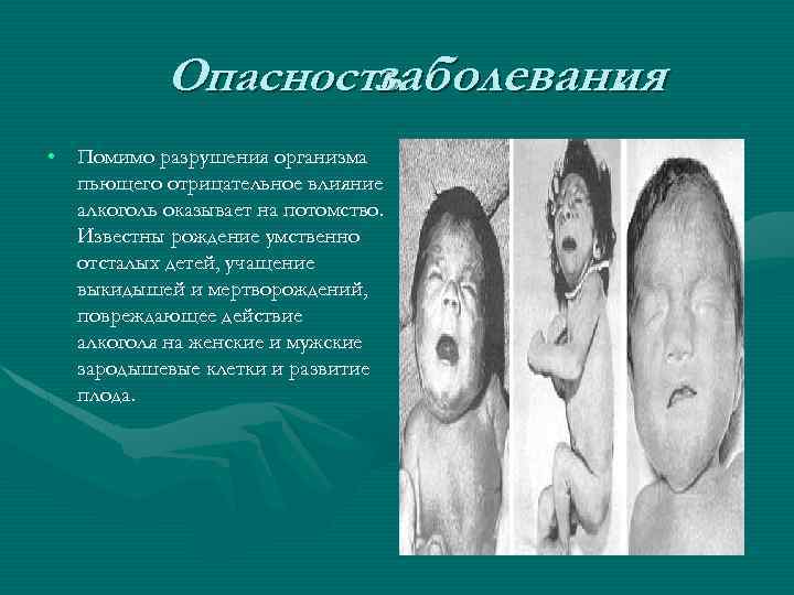Опасность заболевания : • Помимо разрушения организма пьющего отрицательное влияние алкоголь оказывает на потомство.