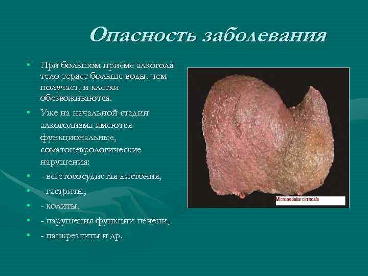 Опасность заболевания • При большом приеме алкоголя тело теряет больше воды, чем получает, и