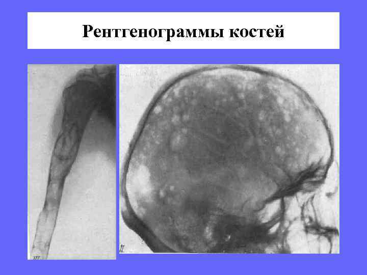 Рентгенограммы костей 