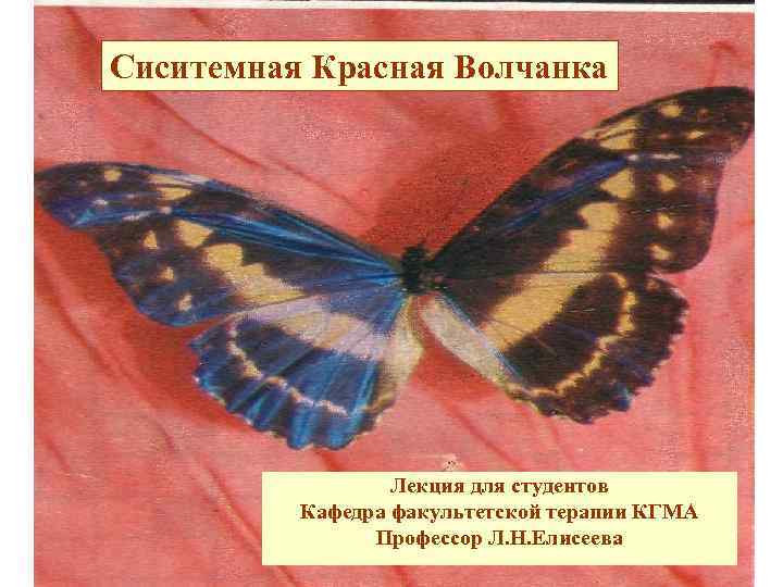 Сиситемная Красная Волчанка Лекция для студентов Кафедра факультетской терапии КГМА Профессор Л. Н. Елисеева