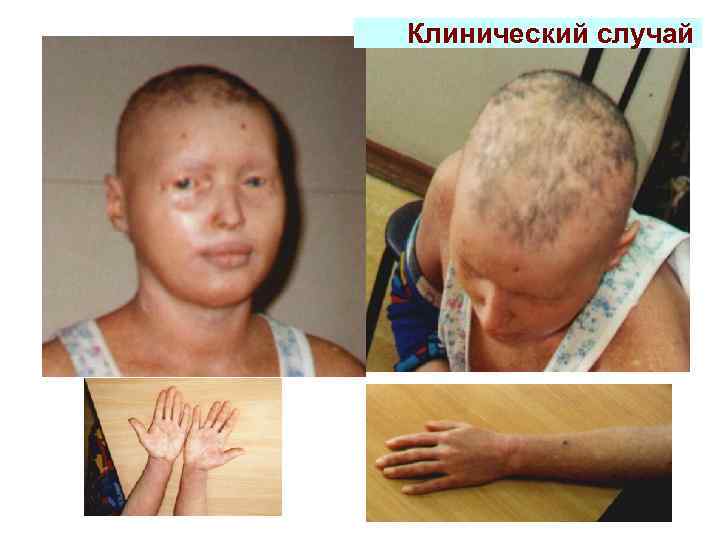 Клинический случай 