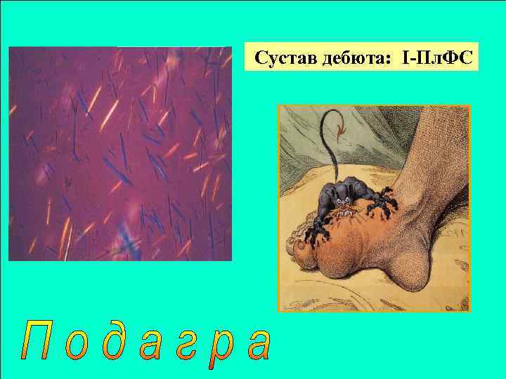 Сустав дебюта: I-Пл. ФС 