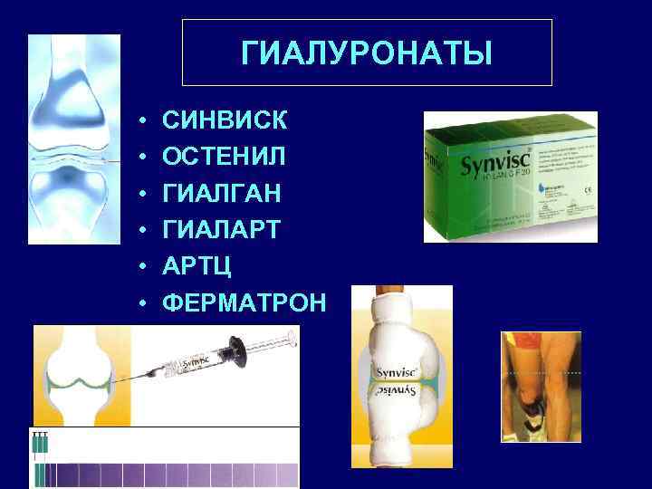 ГИАЛУРОНАТЫ • • • СИНВИСК ОСТЕНИЛ ГИАЛГАН ГИАЛАРТ АРТЦ ФЕРМАТРОН 