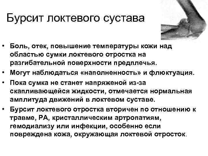 Бурсит локтевого сустава • Боль, отек, повышение температуры кожи над областью сумки локтевого отростка