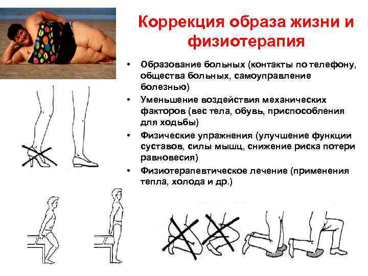 Коррекция образа жизни и физиотерапия • • Образование больных (контакты по телефону, общества больных,