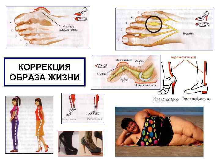 КОРРЕКЦИЯ ОБРАЗА ЖИЗНИ 