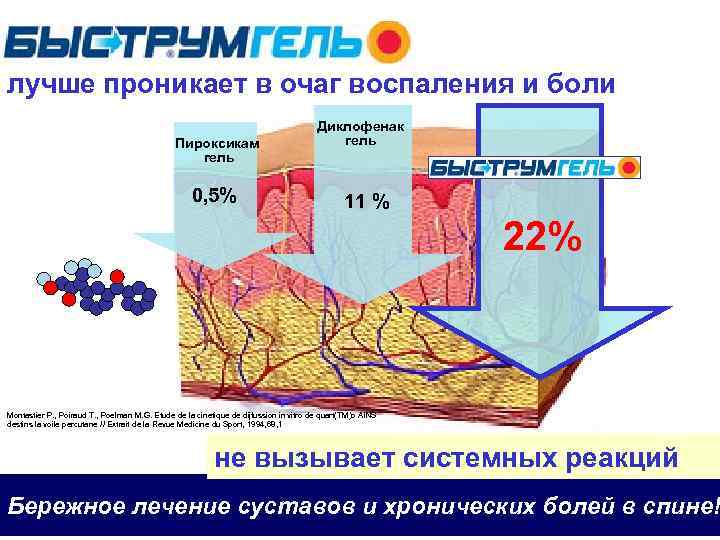 лучше проникает в очаг воспаления и боли Пироксикам гель 0, 5% Диклофенак гель 11