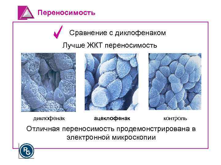 Переносимость Сравнение с диклофенаком Лучше ЖКТ переносимость диклофенак ацеклофенак контроль Отличная переносимость продемонстрирована в