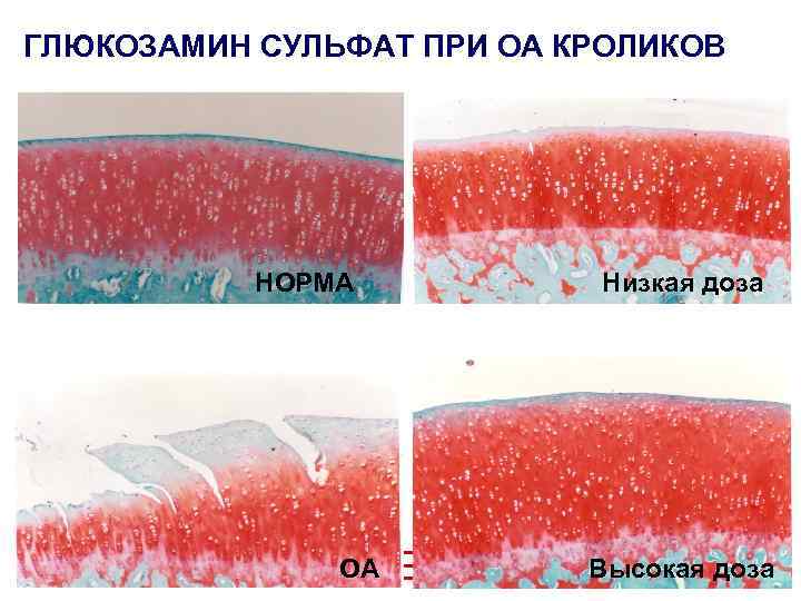 ГЛЮКОЗАМИН СУЛЬФАТ ПРИ OA КРОЛИКОВ НОРМА OA Низкая доза Высокая доза 