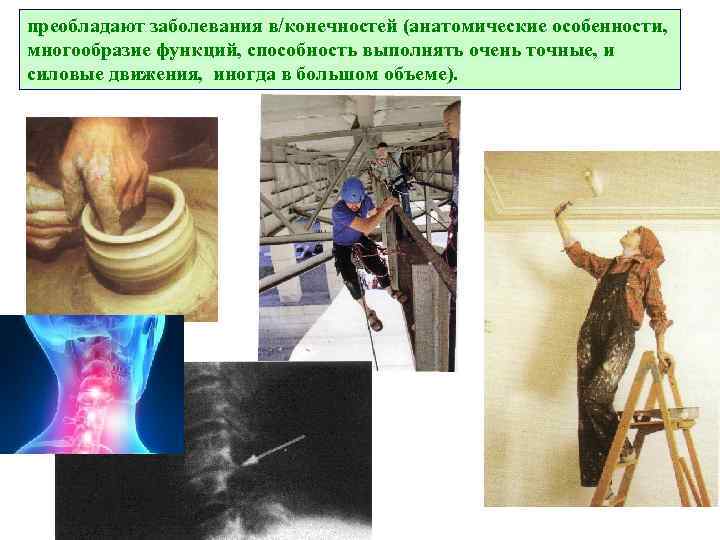 преобладают заболевания в/конечностей (анатомические особенности, многообразие функций, способность выполнять очень точные, и силовые движения,