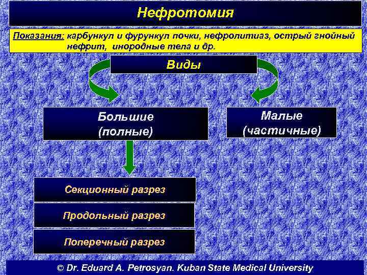 Нефротомия Показания: карбункул и фурункул почки, нефролитиаз, острый гнойный нефрит, инородные тела и др.