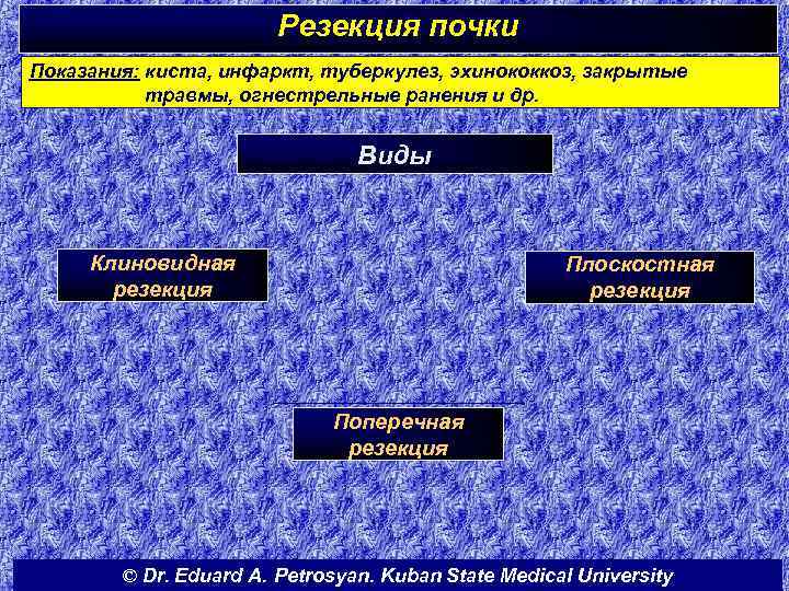 Резекция почки Показания: киста, инфаркт, туберкулез, эхинококкоз, закрытые травмы, огнестрельные ранения и др. Виды