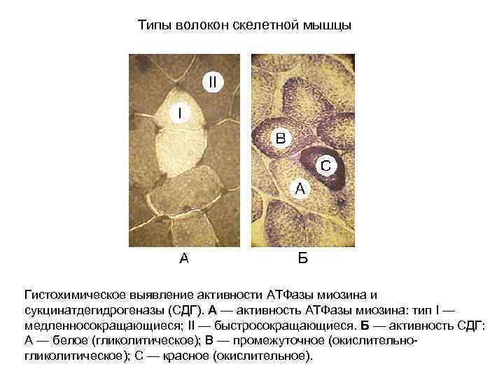 Типы волокон скелетной мышцы Гистохимическое выявление активности АТФазы миозина и сукцинатдегидрогеназы (СДГ). A —