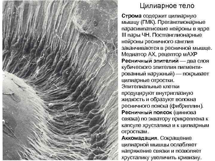 Ресничное тело. Цилиарные отростки глаза. Отростки ресничного тела. Строма ресничного тела. Строение цилиарных отростков.