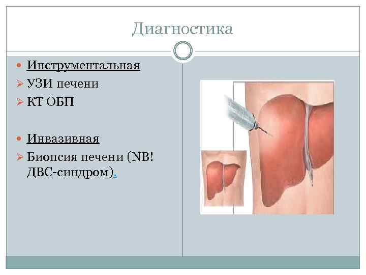 Диагностика Инструментальная Ø УЗИ печени Ø КТ ОБП Инвазивная Ø Биопсия печени (NB! ДВС-синдром).