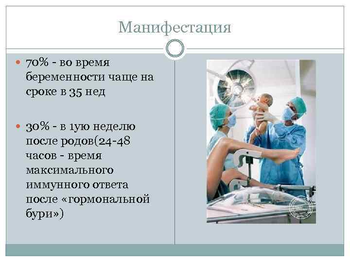 Манифестация 70% - во время беременности чаще на сроке в 35 нед 30% -