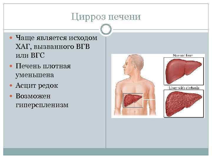 Цирроз печени пенсия