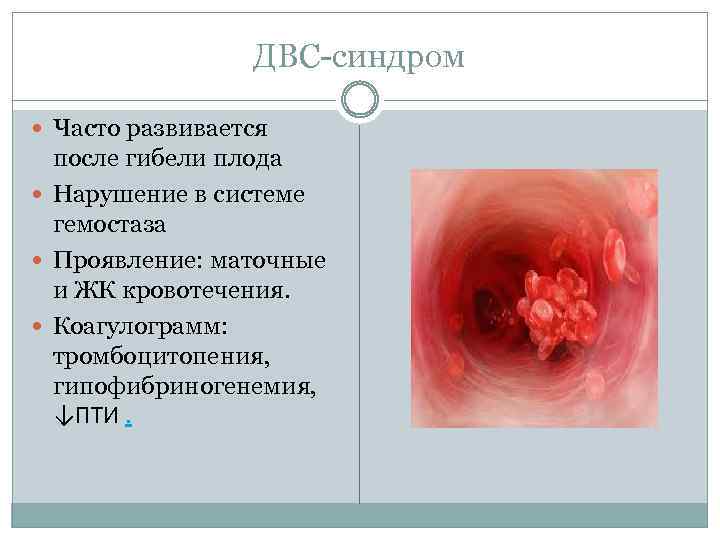 ДВС-синдром Часто развивается после гибели плода Нарушение в системе гемостаза Проявление: маточные и ЖК