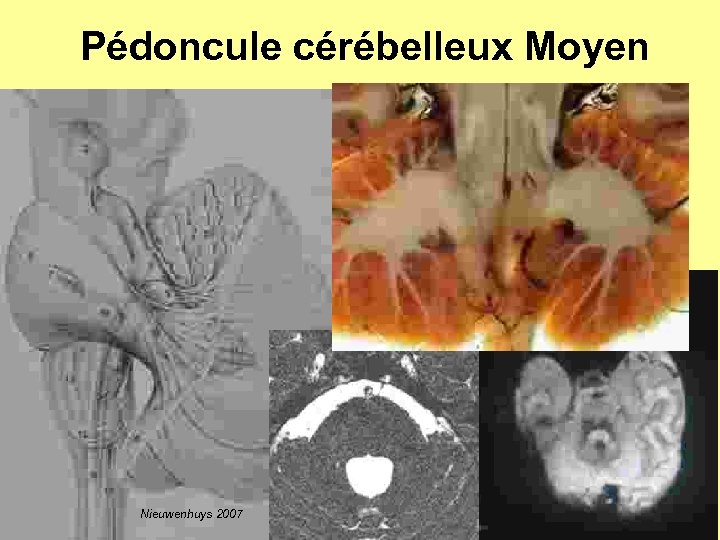 Pédoncule cérébelleux Moyen Nieuwenhuys 2007 