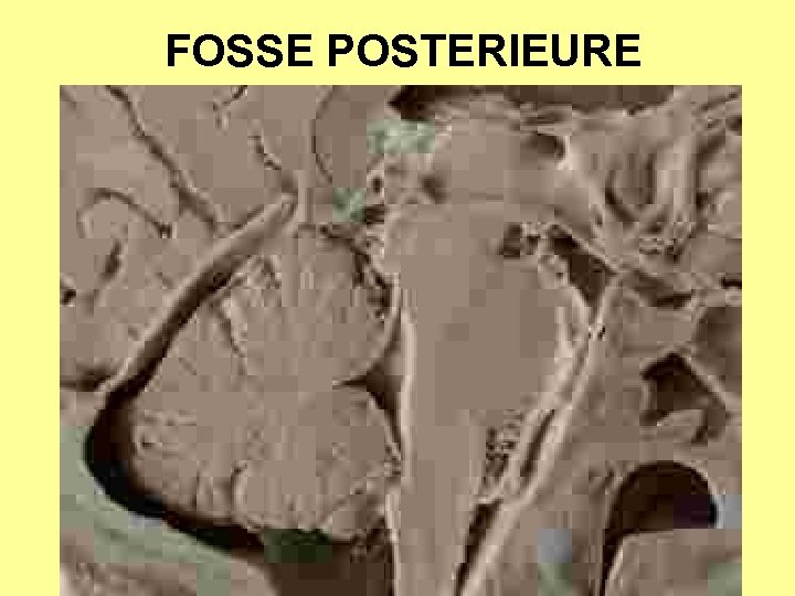 FOSSE POSTERIEURE 