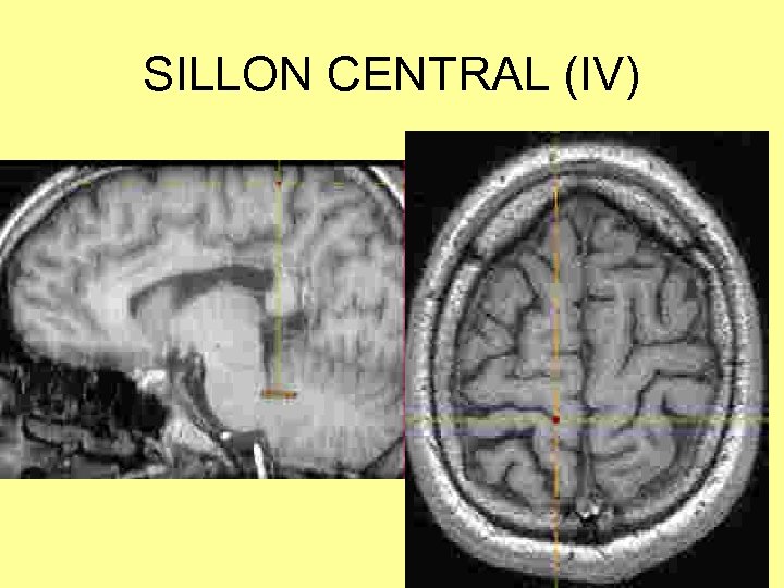 SILLON CENTRAL (IV) 