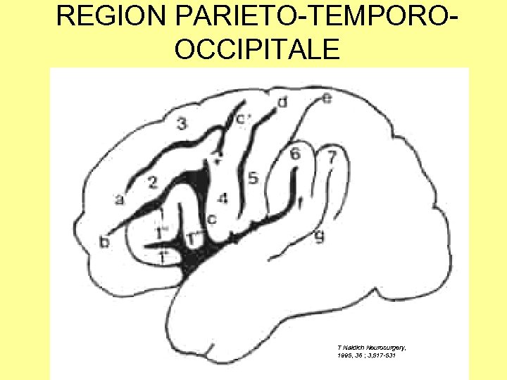 REGION PARIETO-TEMPOROOCCIPITALE T Naidich Neurosurgery, 1995, 36 ; 3, 517 -531 