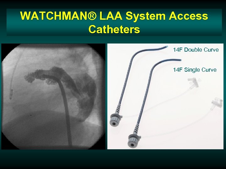 WATCHMAN® LAA System Access Catheters 14 F Double Curve 14 F Single Curve 