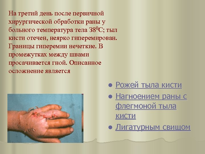 На третий день после первичной хирургической обработки раны у больного температура тела З 80
