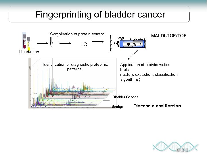Fingerprinting of bladder cancer Combination of protein extract LC Laser + + Flight tube
