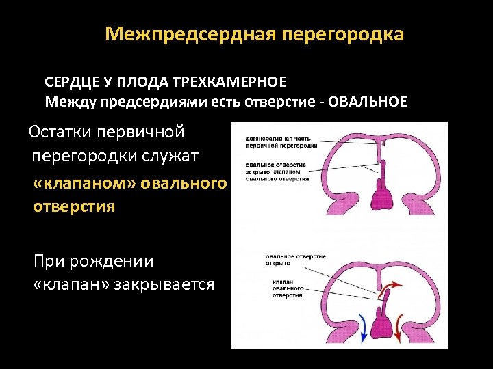 Аневризма межпредсердной перегородки. Первичная межпредсердная перегородка. Межпредсердной перегородки у плода. Межпредсердная перегородка у плода. Овальное отверстие у плода.