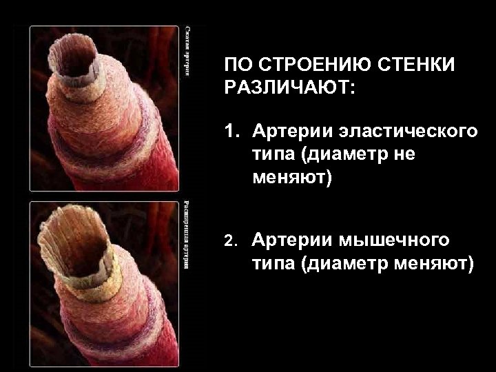 ПО СТРОЕНИЮ СТЕНКИ РАЗЛИЧАЮТ: 1. Артерии эластического типа (диаметр не меняют) 2. Артерии мышечного