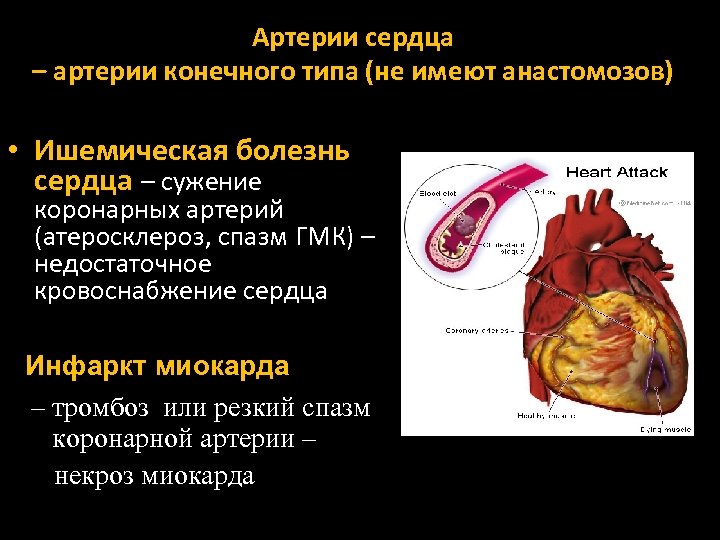 Стеноз артерий сердца