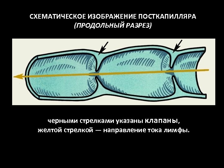СХЕМАТИЧЕСКОЕ ИЗОБРАЖЕНИЕ ПОСТКАПИЛЛЯРА (ПРОДОЛЬНЫЙ РАЗРЕЗ) черными стрелками указаны клапаны, желтой стрелкой — направление тока