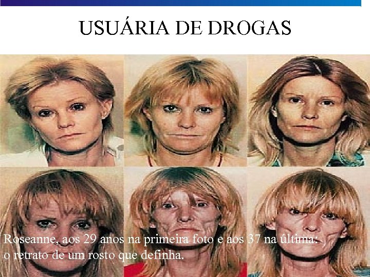 USUÁRIA DE DROGAS Roseanne, aos 29 anos na primeira foto e aos 37 na