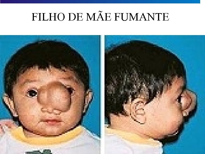 FILHO DE MÃE FUMANTE 