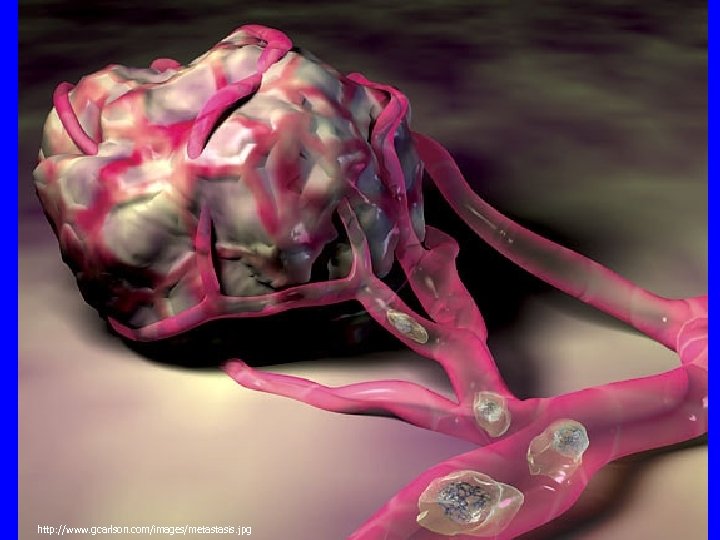 http: //www. gcarlson. com/images/metastasis. jpg 
