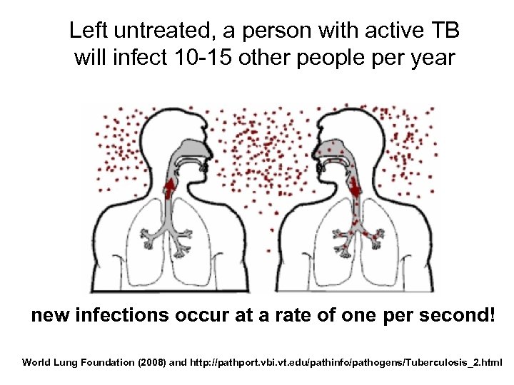 Left untreated, a person with active TB will infect 10 -15 other people per