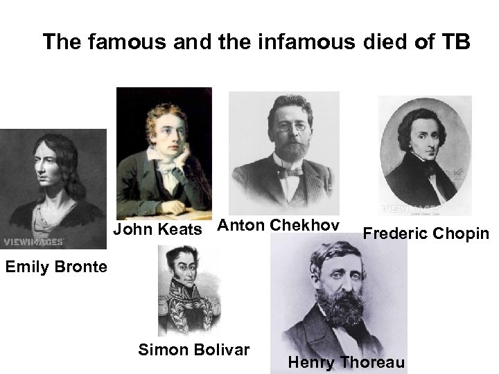 The famous and the infamous died of TB John Keats Anton Chekhov Frederic Chopin