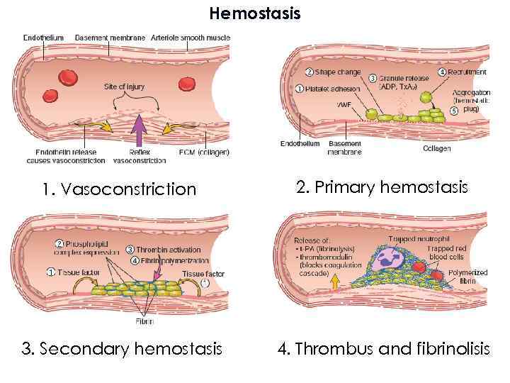 Hemostasis 1. Vasoconstriction 2. Primary hemostasis 3. Secondary hemostasis 4. Thrombus and fibrinolisis 