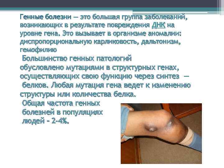 Генные болезни — это большая группа заболеваний, возникающих в результате повреждения ДНК на уровне